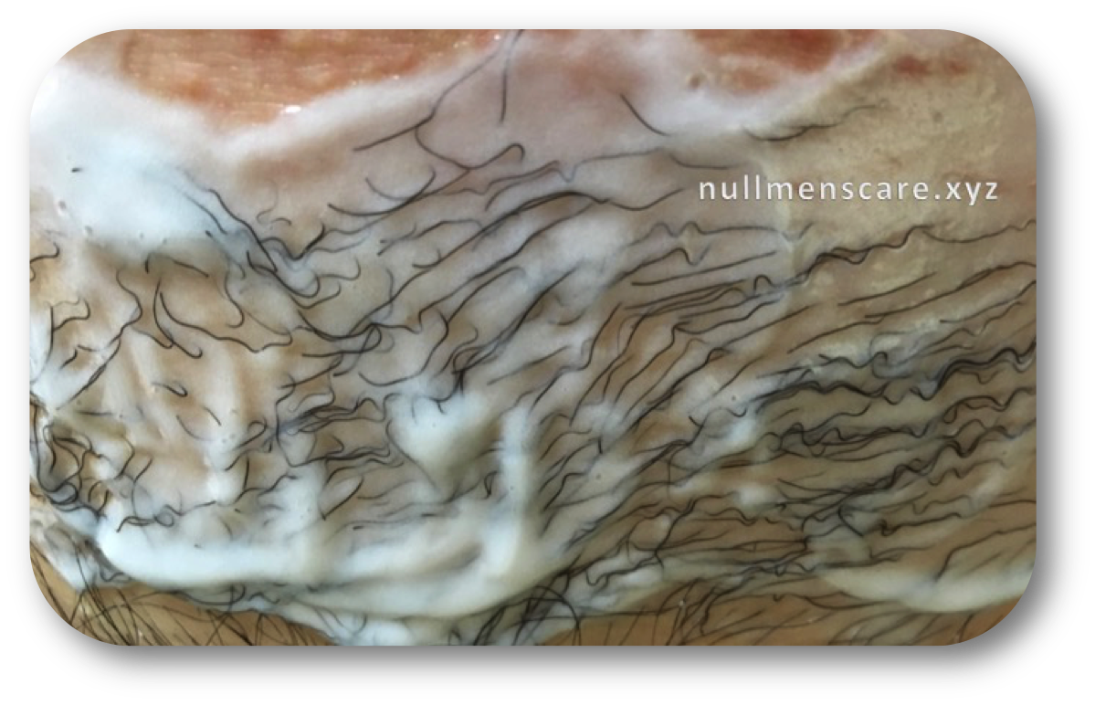 クリームの効果で除毛が始まった