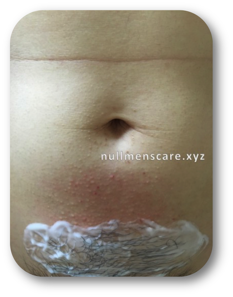 クリームを塗布