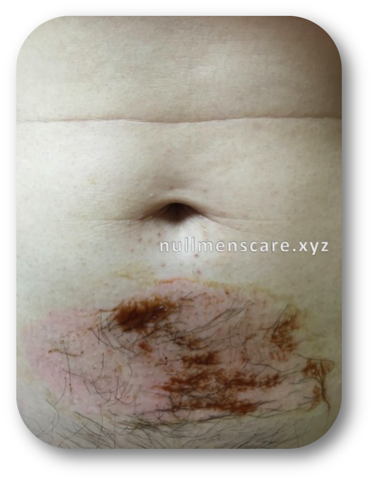 ワックスシートを剥がす