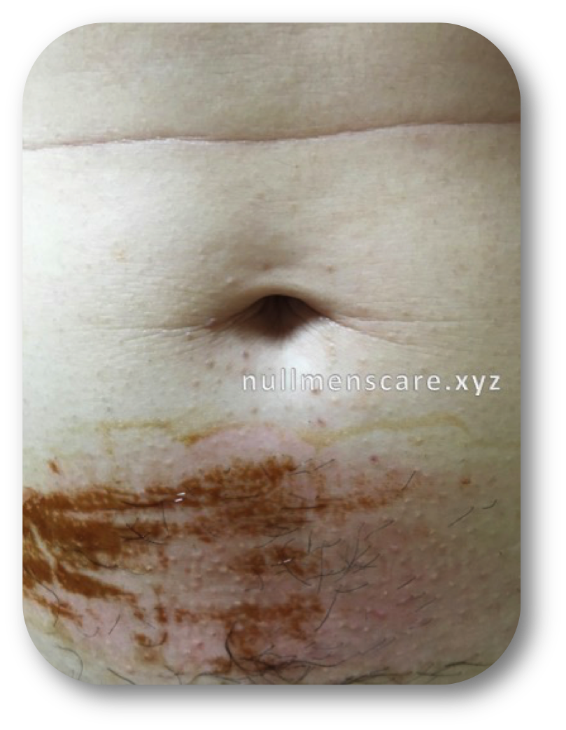 ワックスシートを剥がす2