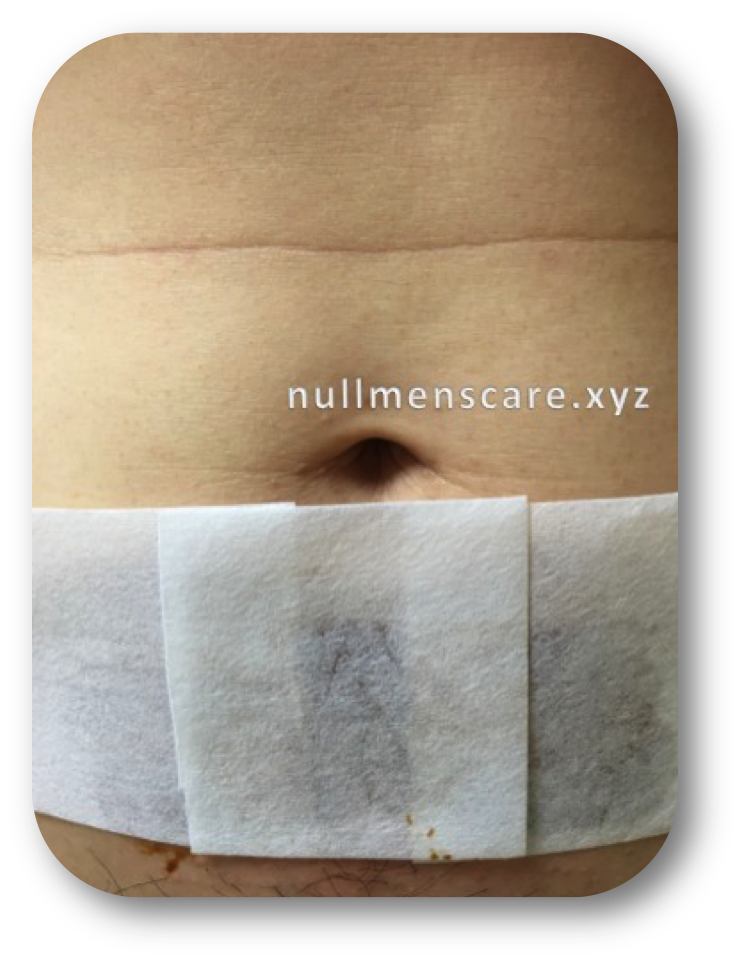 ワックスシートを貼り付ける3